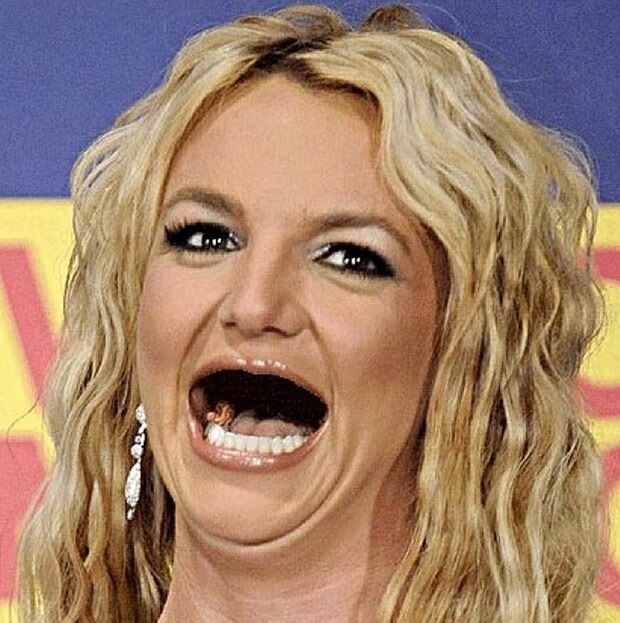23 LOL Pictures Of Celebrities Without Teeth That Will Definitely Amuse You