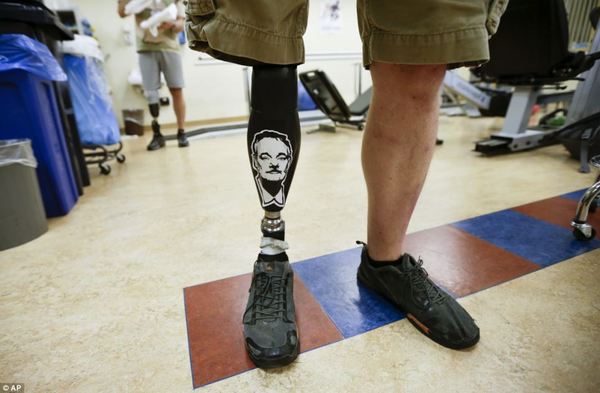 This Marine Lost A Hand And A Leg… Yet Kept His Smile