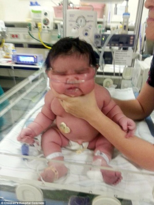baby weighing 14 lbs