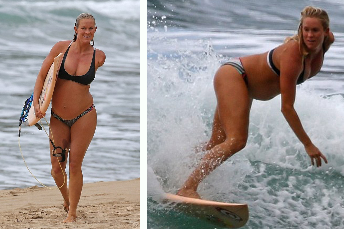 25-year-old Bethany Hamilton was attacked as a teenager by a shark causing ...