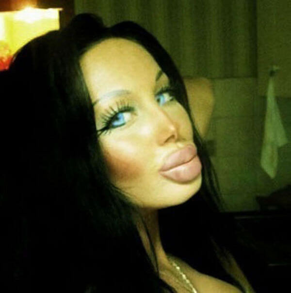 plastic surgery fails 26