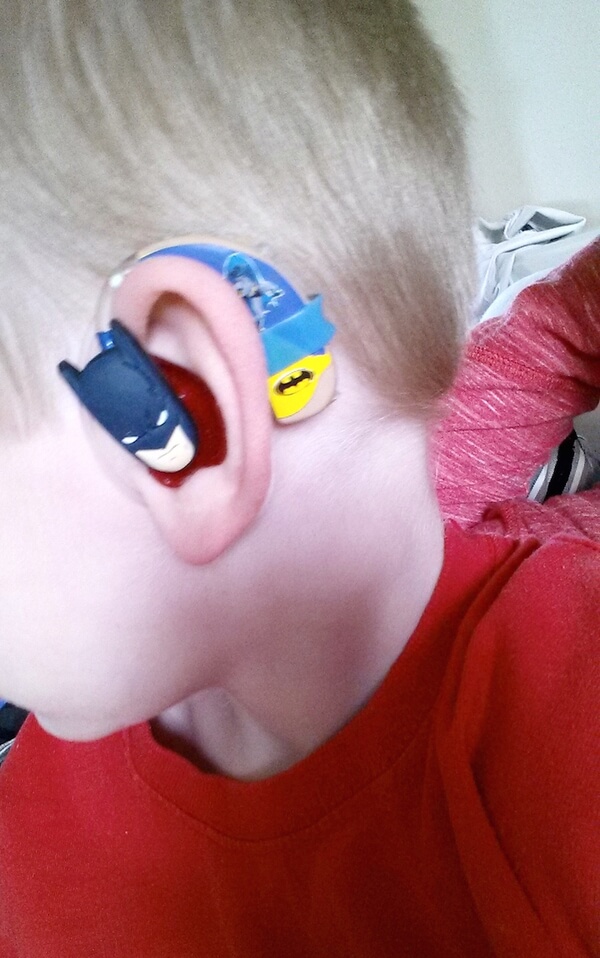 Mom Creates Awesome Superhero Hearing Aids For Kids