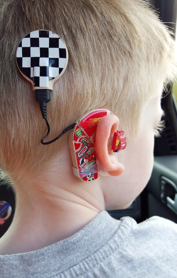 custom hearing aid 2