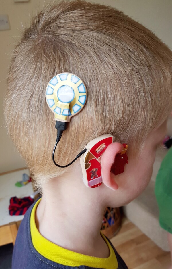 Mom Creates Awesome Superhero Hearing Aids For Kids