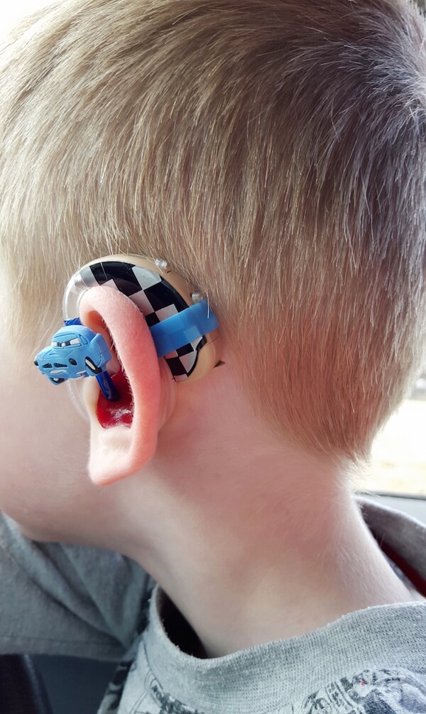 Mom Creates Awesome Superhero Hearing Aids For Kids