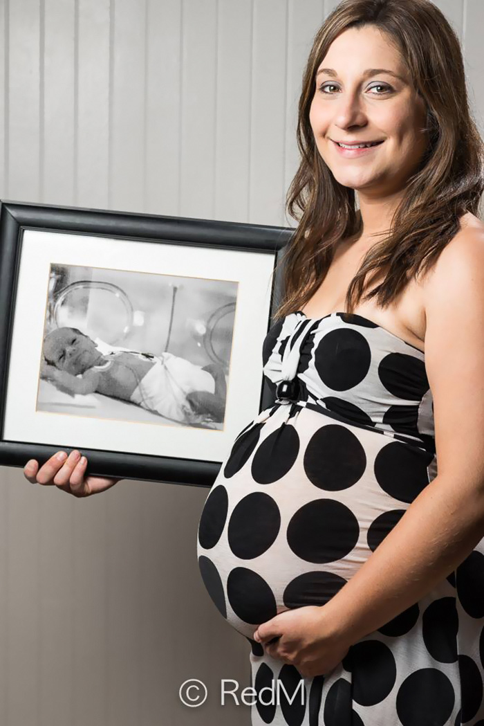 Portraits Of Premature Babies 1