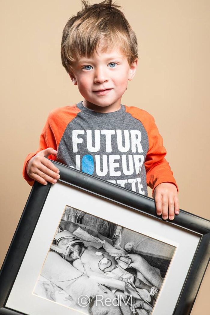 Portraits Of Premature Babies 3