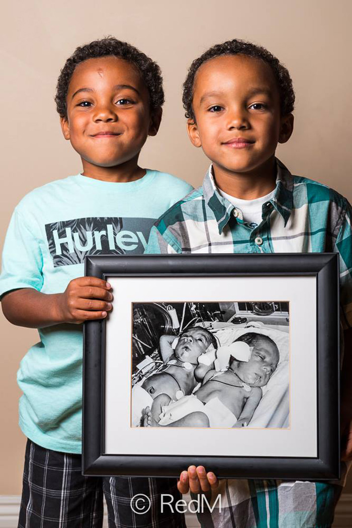 Portraits Of Premature Babies 8