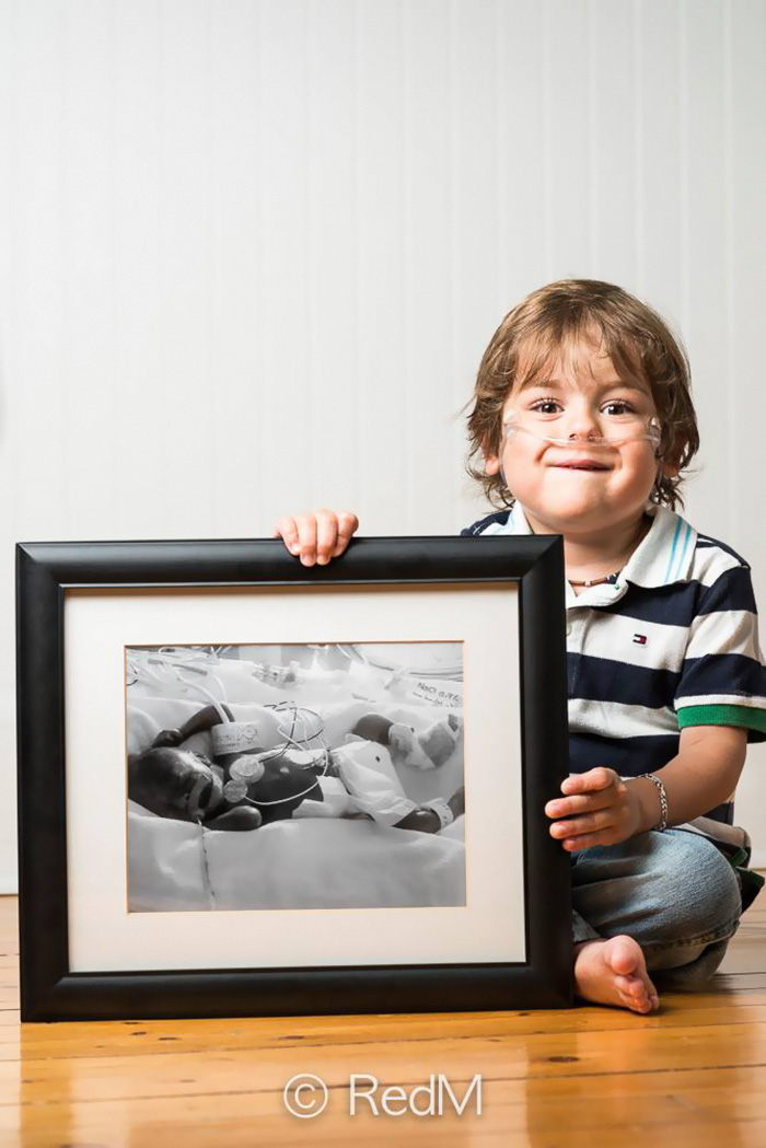 Portraits Of Premature Babies 9