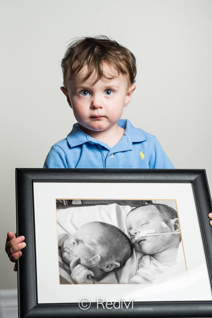 Portraits Of Premature Babies 10