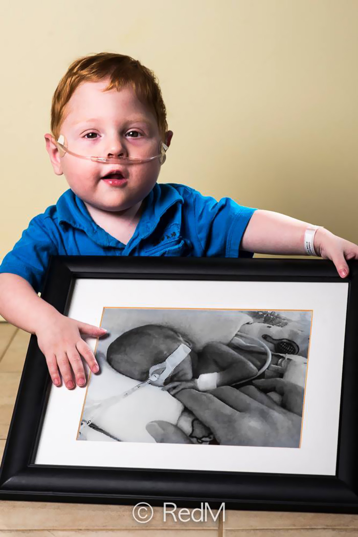 Portraits Of Premature Babies 14