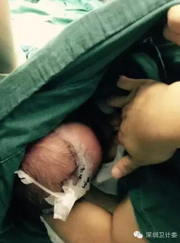 nurse breastfeeds infant 8