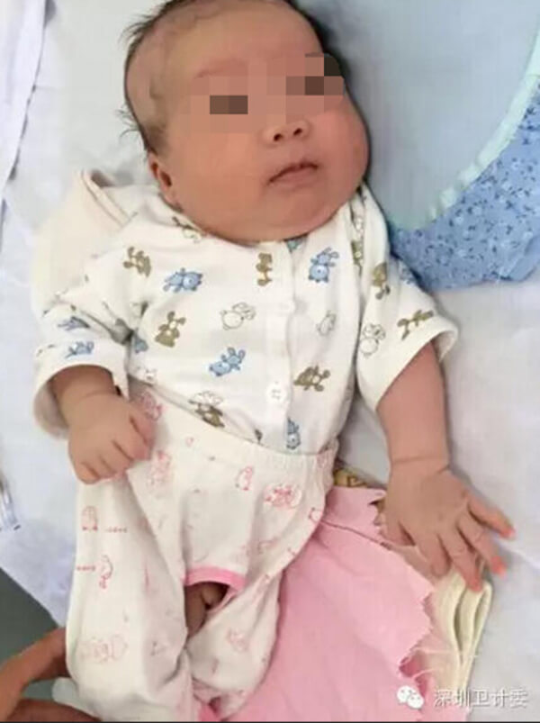 nurse breastfeeds infant 9