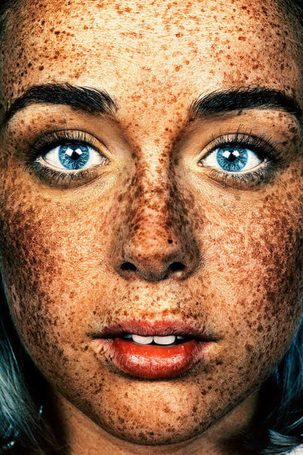 Freckles Beautiful 13