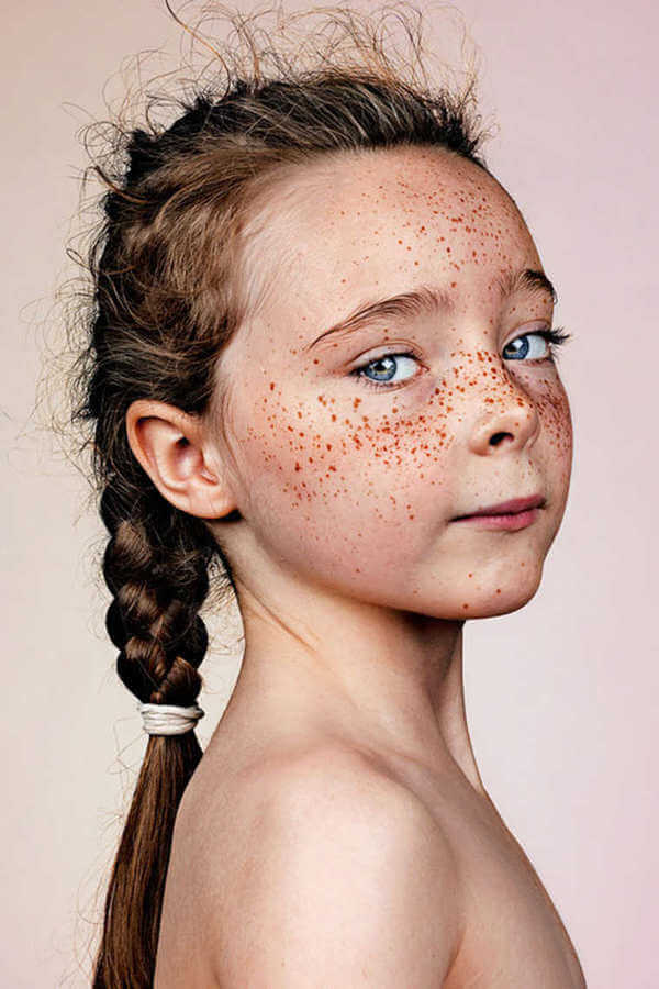 Amazing Portraits That Prove Freckles Are Beautiful