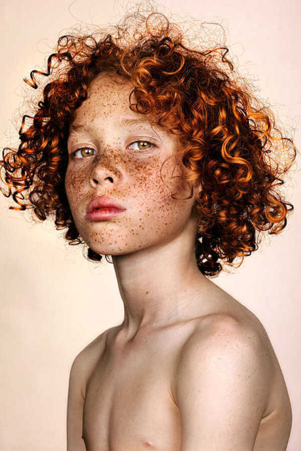 Freckles are Beautiful 21