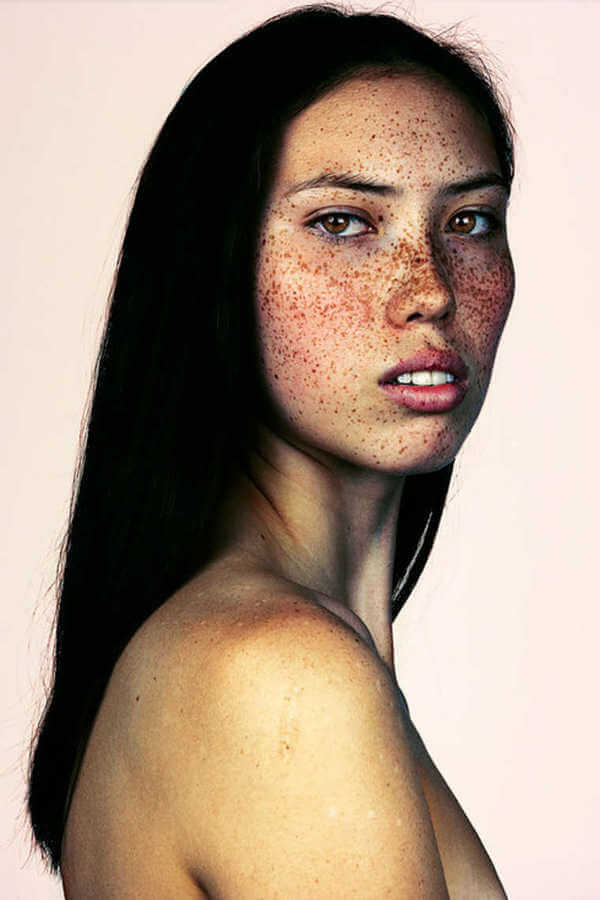 Amazing Portraits That Prove Freckles Are Beautiful 