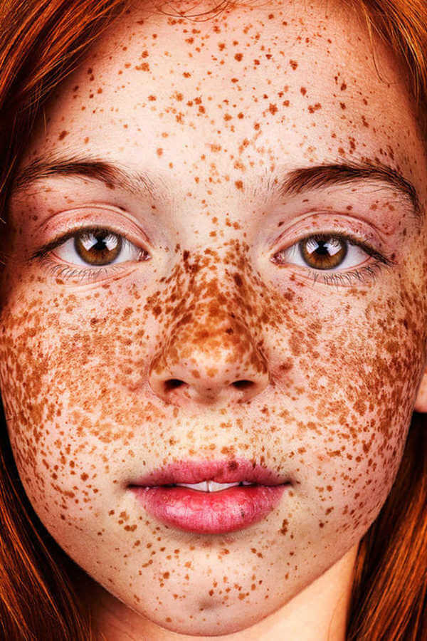 Freckles Beautiful 18