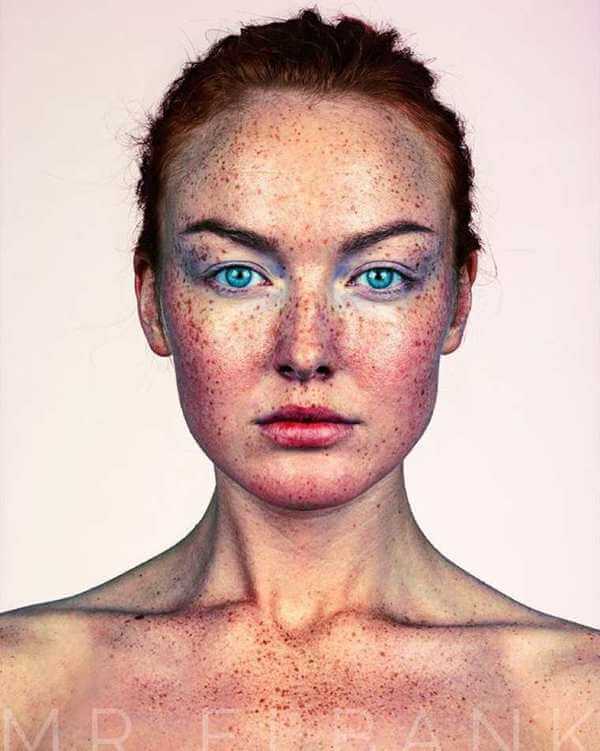 Freckles are Beautiful 7