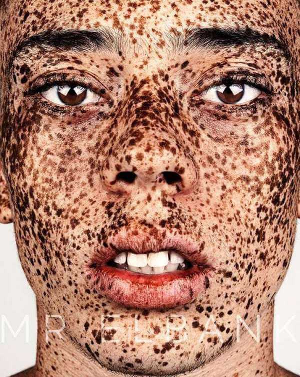 Freckles are Beautiful 11