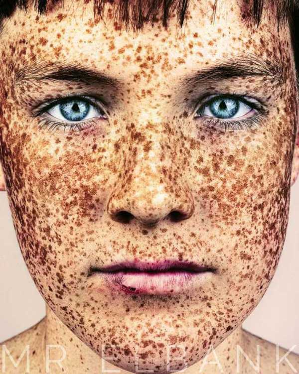 Amazing Portraits That Prove Freckles Are Beautiful 