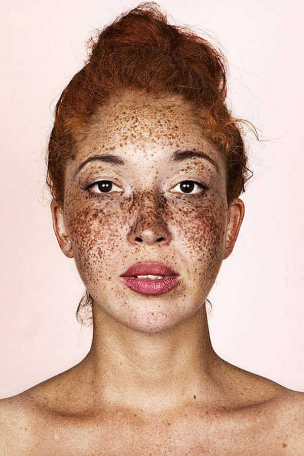 Freckles are Beautiful 9