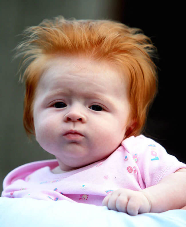 15 HQ Images Pictures Of Babies With Red Hair : EgyptSearch Forums: The world as seen through Albino eyes