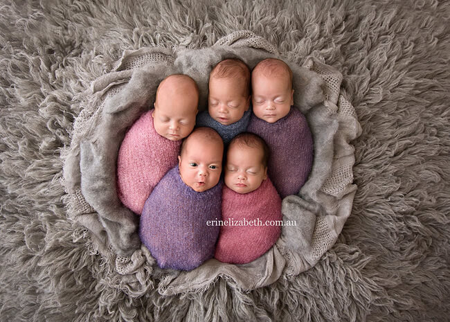 Mom Gives Birth To Quintuplets 2