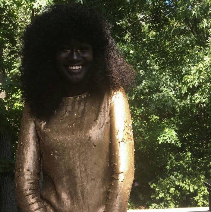 Teen Khoudia Diop Who Was Bullied Because Of Her Dark Skin Becomes A Popular Model And Takes