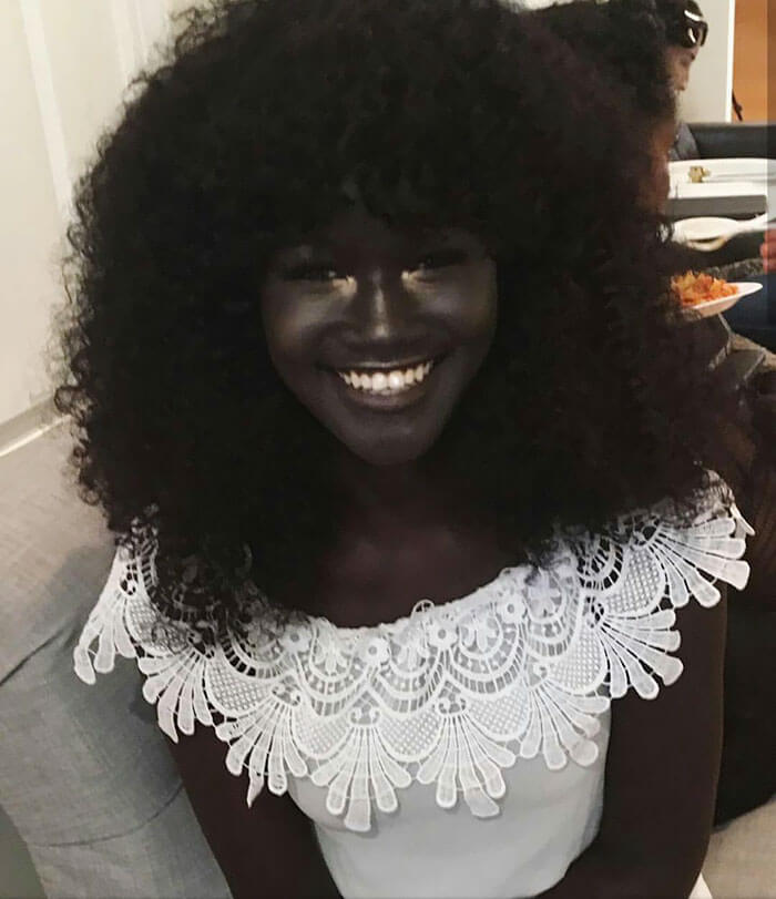Teen Khoudia Diop Who Was Bullied Because Of Her Dark Skin Becomes A
