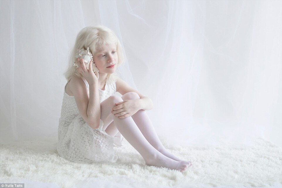 albinos portraits by yulia taits (1)