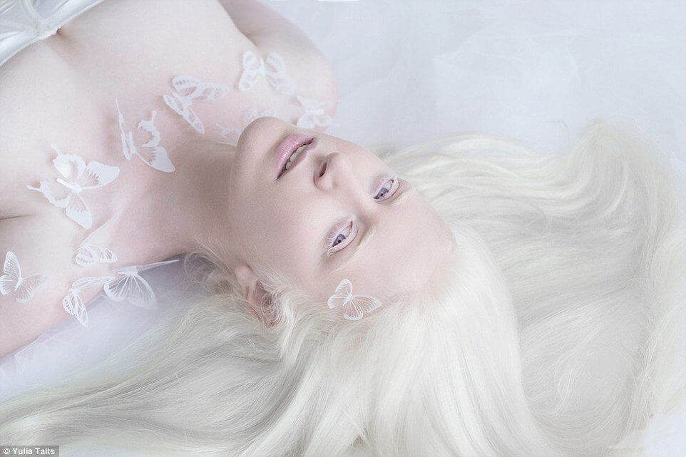 albinos portraits by yulia taits 2 (1)