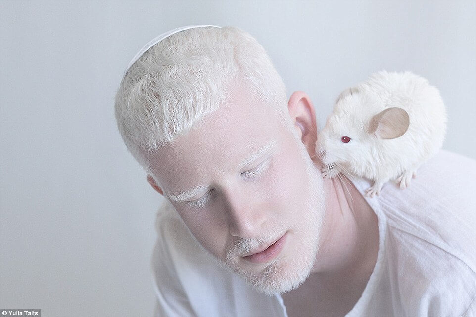 albinos portraits by yulia taits 3 (1)