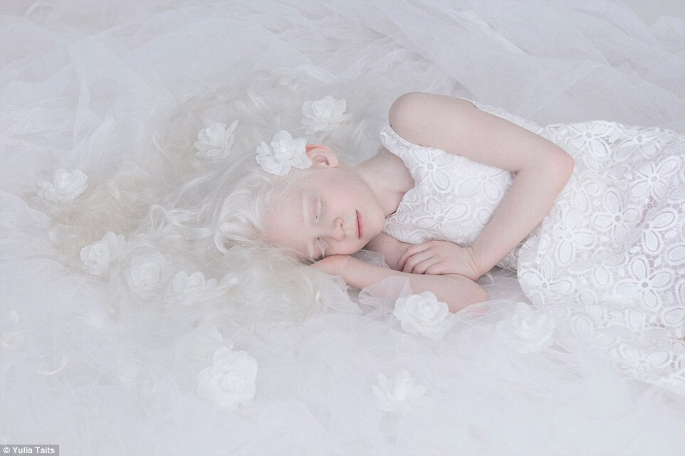 albinos portraits by yulia taits 6 (1)