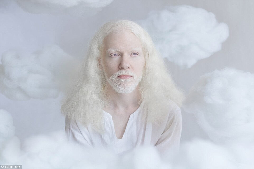 albinos portraits by yulia taits 7 (1)