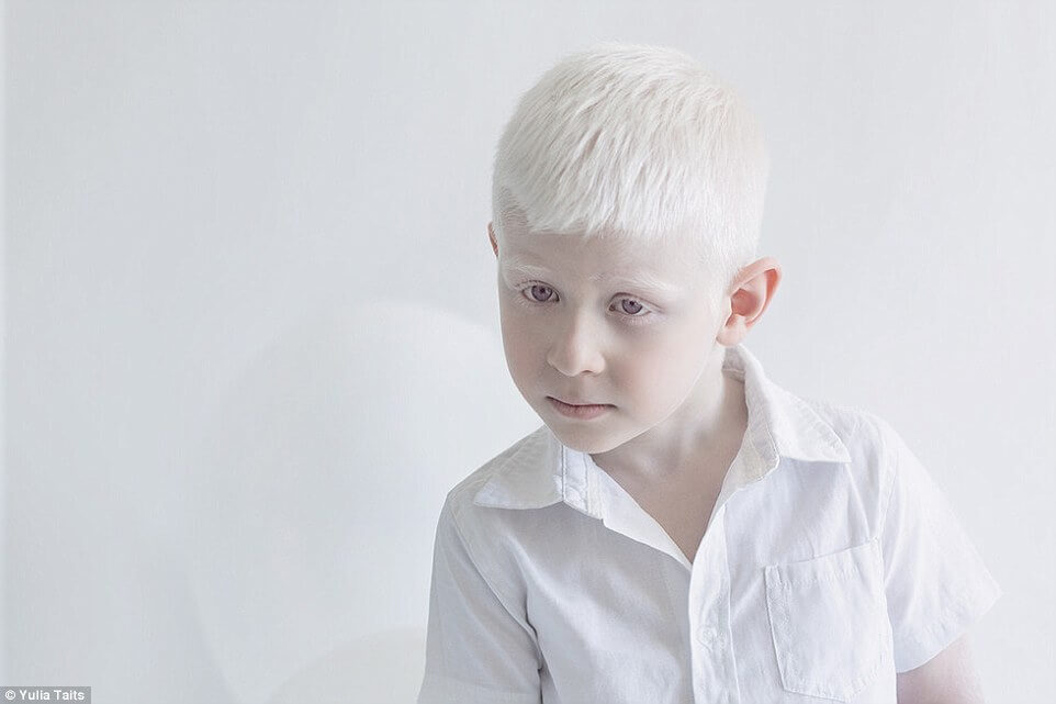 albinos portraits by yulia taits 9 (1)