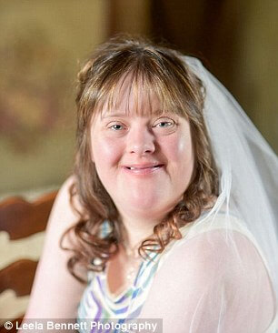 down syndrome couple magical wedding 6 (1)