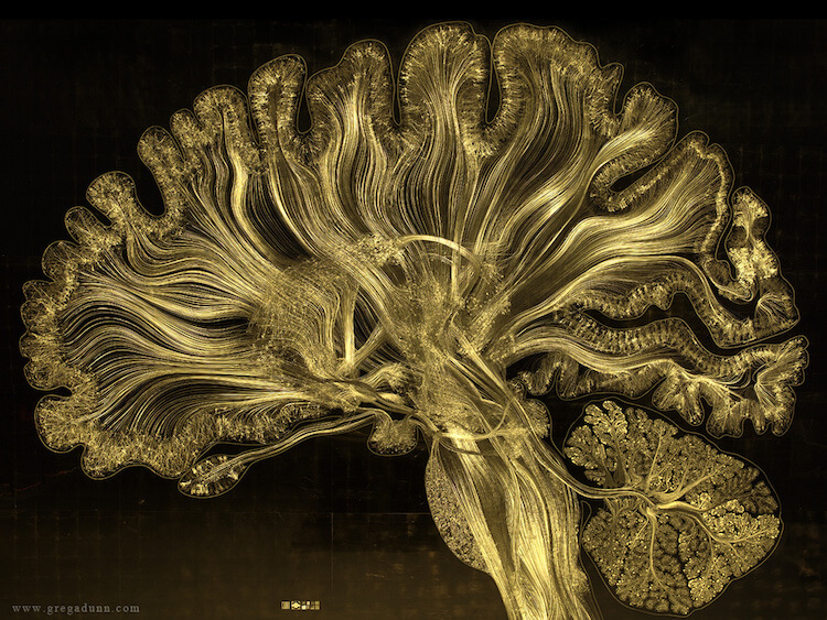 Visualizations of Brain Scans 10 (1)