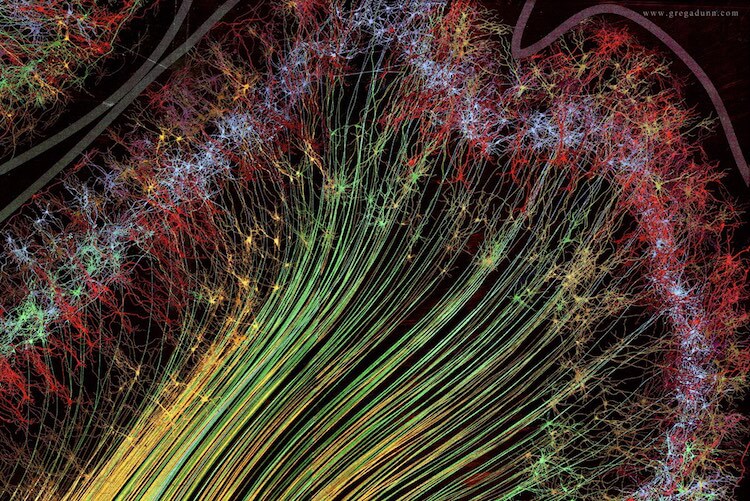 Visualizations of Brain Scans 2 (1)