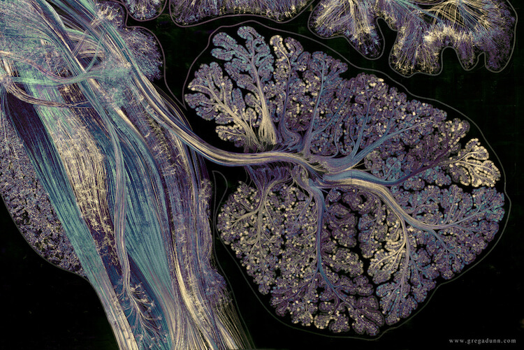 Visualizations of Brain Scans 3 (1)