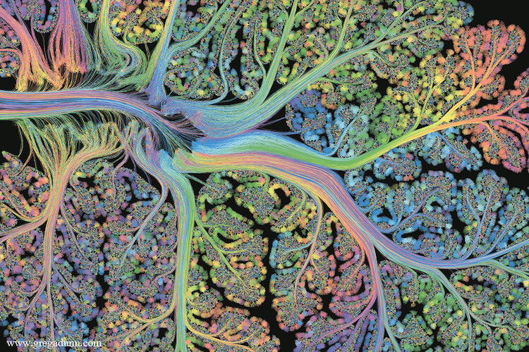 Stunning Visualizations Of Brain Scans Enhanced With 1,750 Gold Leafs ...