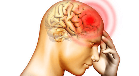 how to get rid of a headache 3 (1)