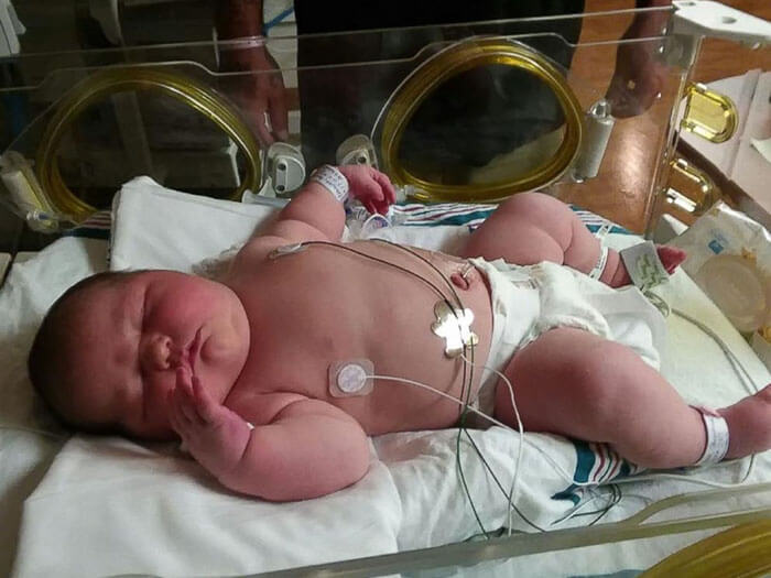 Mom Gives Birth To A 13.5Lbs Baby 2