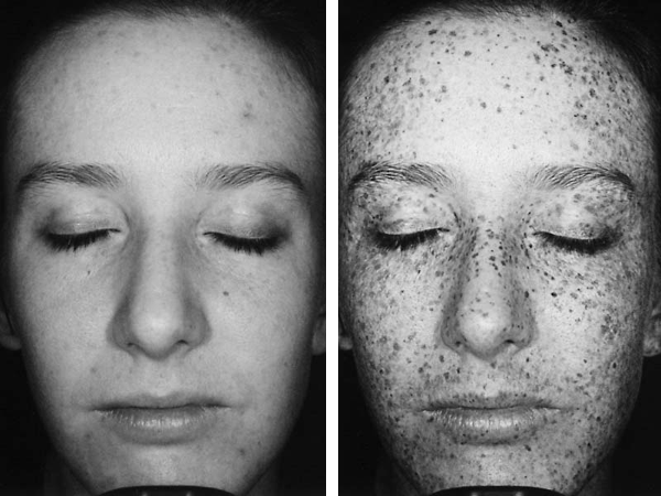 How our skin under ultraviolet light looks like 2