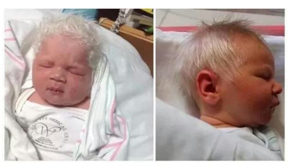 baby born with white hair 6 (1)