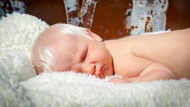 Baby Born With White Hair Is One Of The Rarest And Most ...