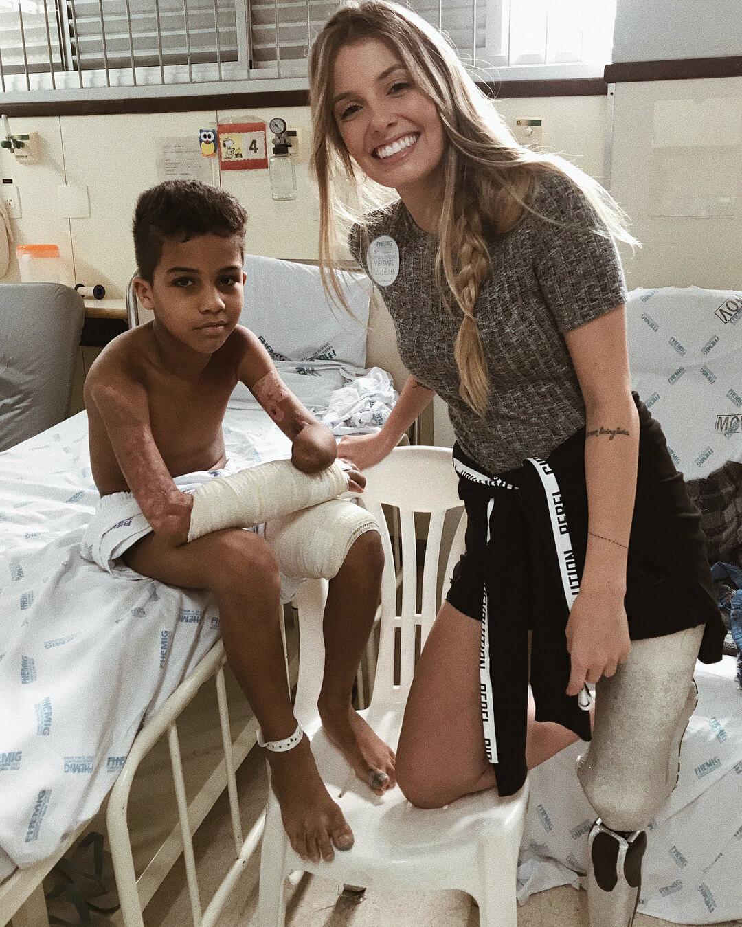 Amputee model Paola Antonini posts bikini photos to show off her prosthetic  limb