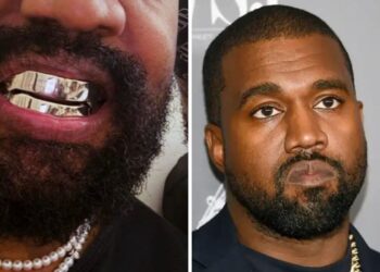 Bling or Bleaching? The Real Cost of Kanye’s Titanium Smile is simply shocking
