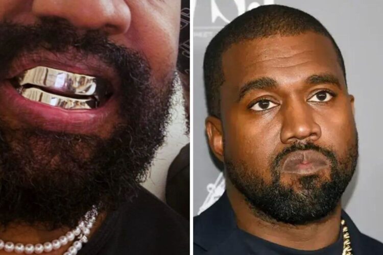 Bling or Bleaching? The Real Cost of Kanye's Titanium Smile is simply ...