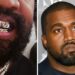 Bling or Bleaching? The Real Cost of Kanye’s Titanium Smile is simply shocking